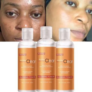 RAPID ACNE CLEAR TONER